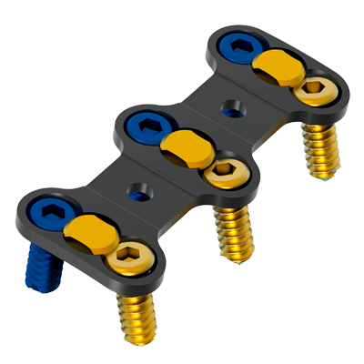 CERVICAL-PLATE-DEMO.1